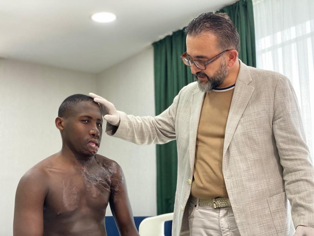 Acılı bekleyiş: Yüzü ve boynunda ağır yanıklar vardı! Ugandalı çoban, 10 yıl sonra Türkiye de tedavi edildi... 4