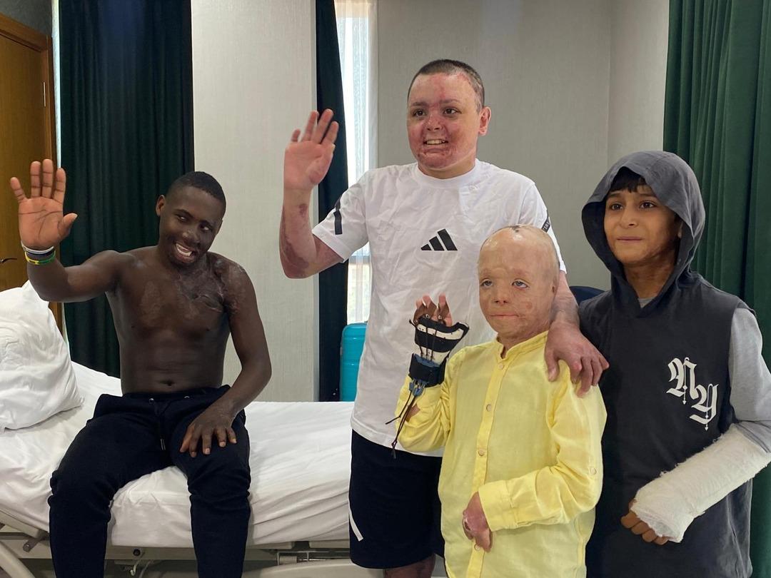 Acılı bekleyiş: Yüzü ve boynunda ağır yanıklar vardı! Ugandalı çoban, 10 yıl sonra Türkiye de tedavi edildi... 2